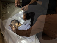 Gaza man dies of severe malnutrition