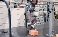 Bionic knee helps amputees walk faster and climb stars
