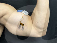 Wearable hydration sensor