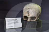 Edinburgh University's 'skull room' highlights its complicated history with racist science.
