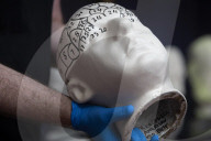 Edinburgh University's 'skull room' highlights its complicated history with racist science.