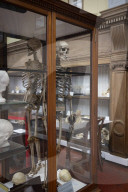 Edinburgh University's 'skull room' highlights its complicated history with racist science.