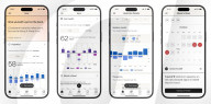 Toilet AI health monitor