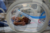 Palestinian Children Wait to Go Abroad to Receive Medical Treatment - Gaza