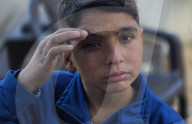 Gaza boy struck in the eyes by shrapnel from Israeli missile