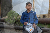 Gaza boy struck in the eyes by shrapnel from Israeli missile